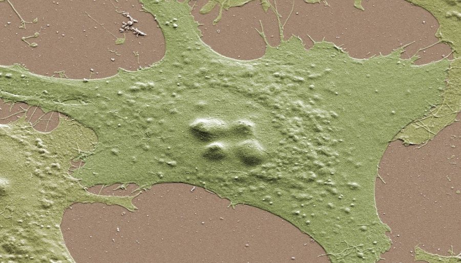 wann-ist-knochenaufbau-noetig-bei-zahnimplantaten