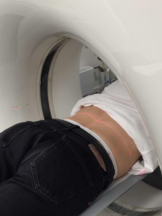 rueckenschmerzen-ct-gesteuerte-schmerztherapie