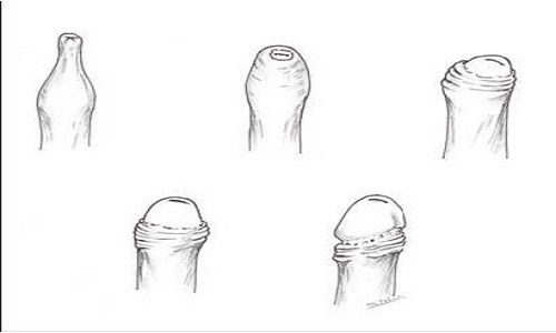 Ajoyib surat yaqindan