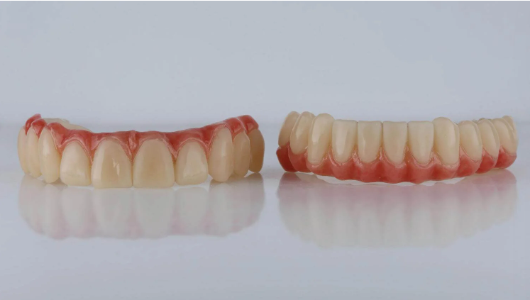 Geçici Diş