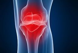 arthrosebehandlung-mit-hyaloronsaeure