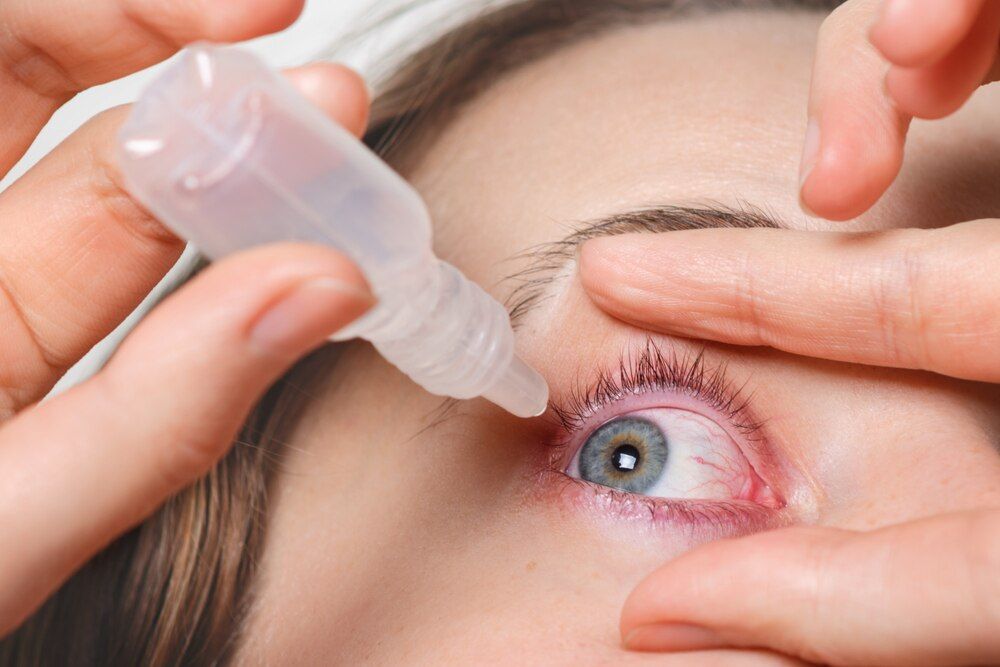 close-up de mulher pingando gotas no olho vermelho, tem conjuntivite ou glaucoma, má visão e dor. conceito de tratamento de dor nos olhos. mulher cura olho vermelho sangue.