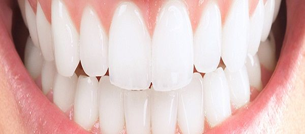 Gömülü Köpek Dişleri