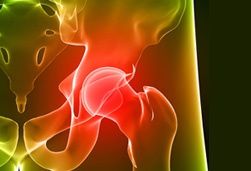 das-kuenstliche-hueftgelenk