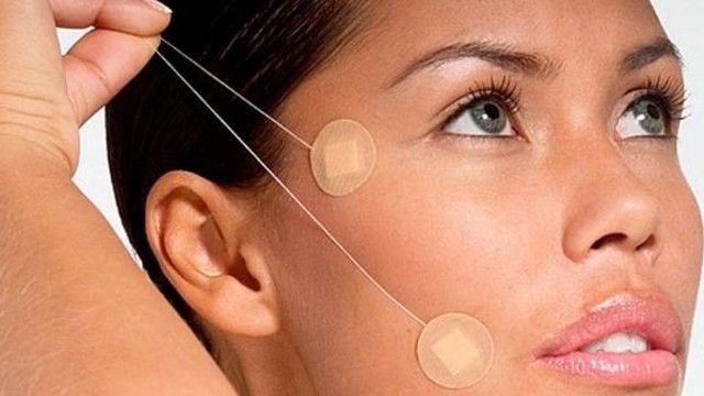 İPLERLE CİLT GERME