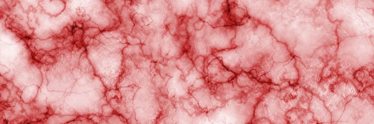 Kılcal Damar Kanaması Nedir?