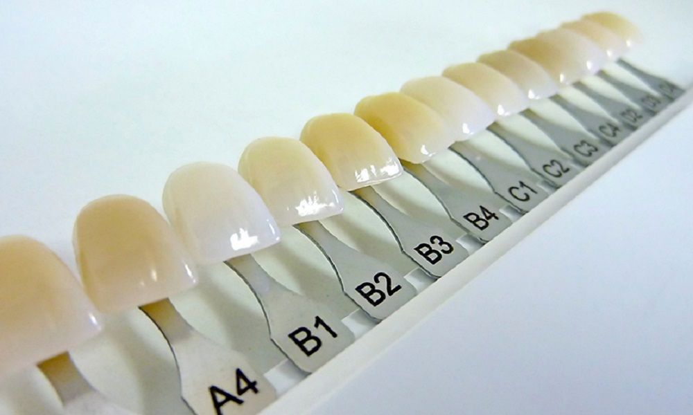 Lamina Diş Kaplamalar