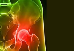 Wissenschaftler finden Zusammenhang zwischen multiplem Myelom und bestimmten Berufsgruppen