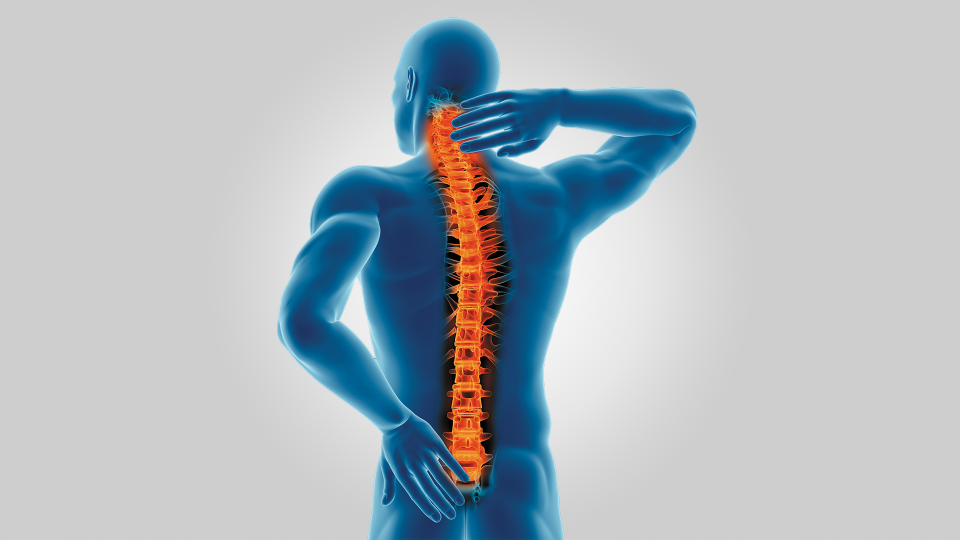 Omurga ve Omurilik Tümörleri: Tanı, Tedavi ve Yönetim