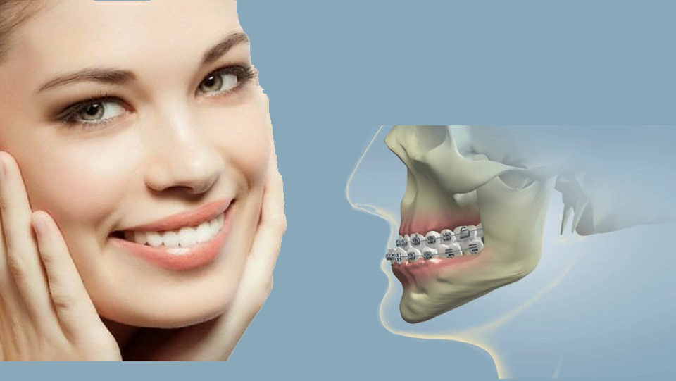 Ortognatik Cerrahi Tedavileri