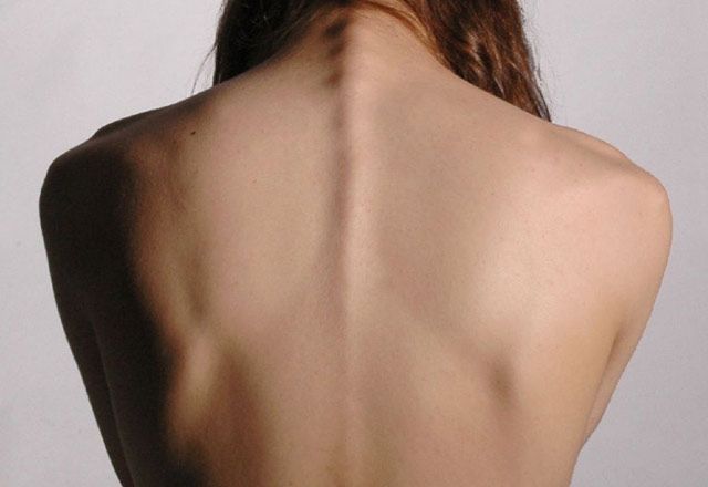 Osteoporotik Omurga Kırıkları