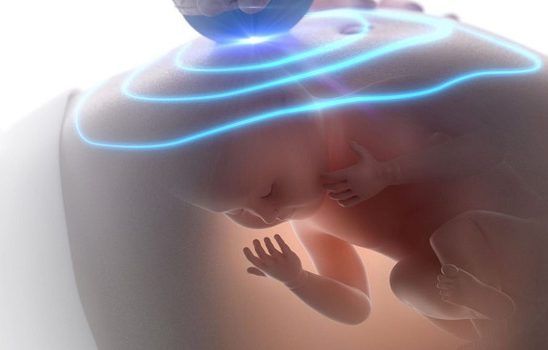 Perinatoloji (Riskli Gebelik Uzmanlığı) Nedir?