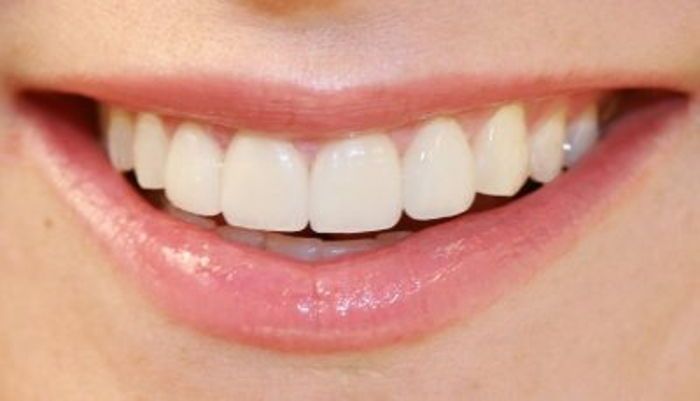 Periodontoloji Nedir? 2