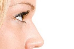 augenlid-straffung-neue-laser-therapie-zur-oberlidstraffung