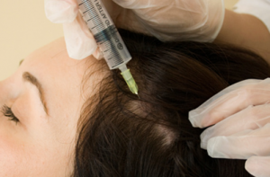 Saç Mezoterapisi ve PRP