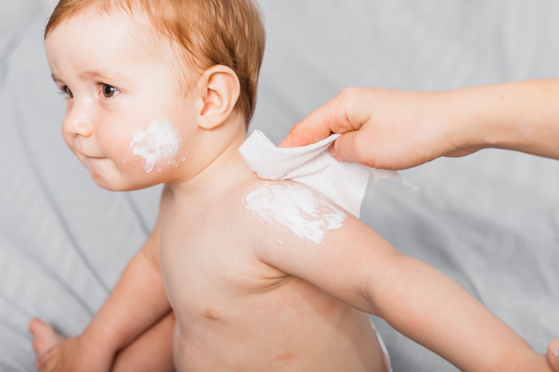 Sarna en bebés y niños: cómo detectarla y tratarla