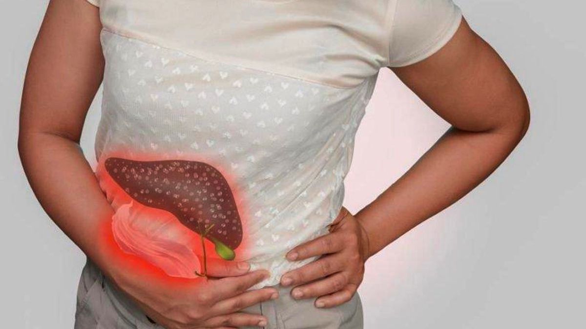 Siroz Hastalığının Sebepleri ve Tedavisi