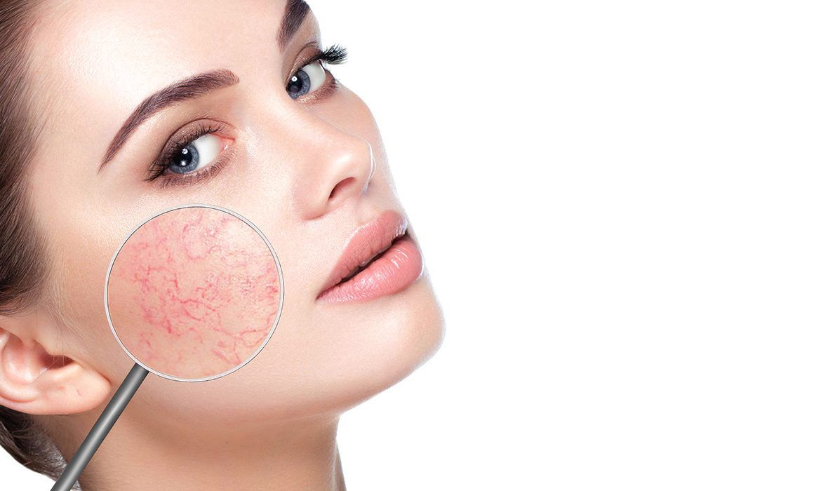 Sorularla Kozmetik Dermatoloji