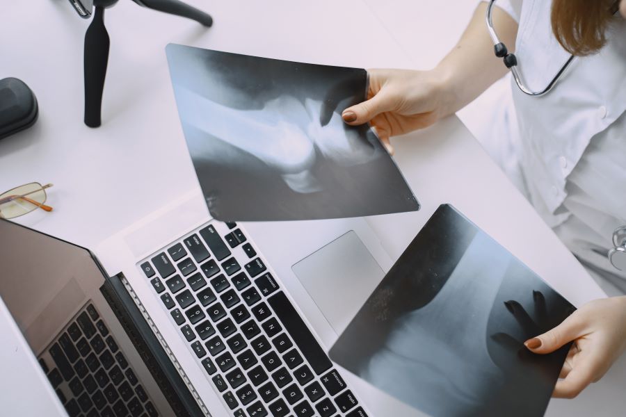 doctora sostiene radiografia rodilla tac