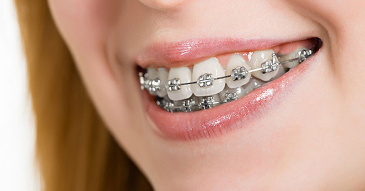 Teller Dişimi Çürütür Mü?