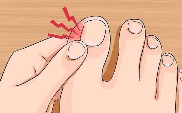 Tırnak Batması Nedir?