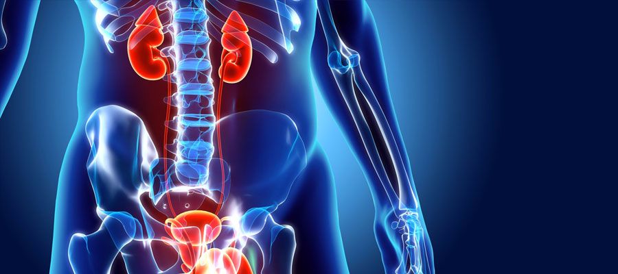 VCUG: Voiding Sistoüretrografi : Voiding: Sondalı İşeme Filmi : Sondalı film