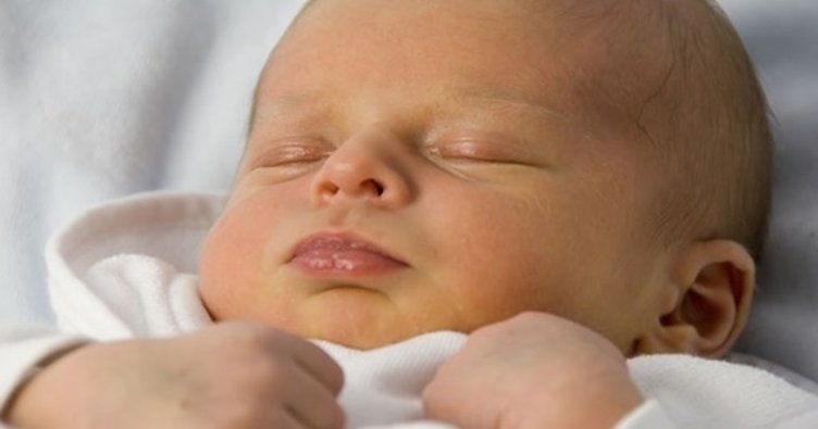 Yenidoğan Sarılığı 2