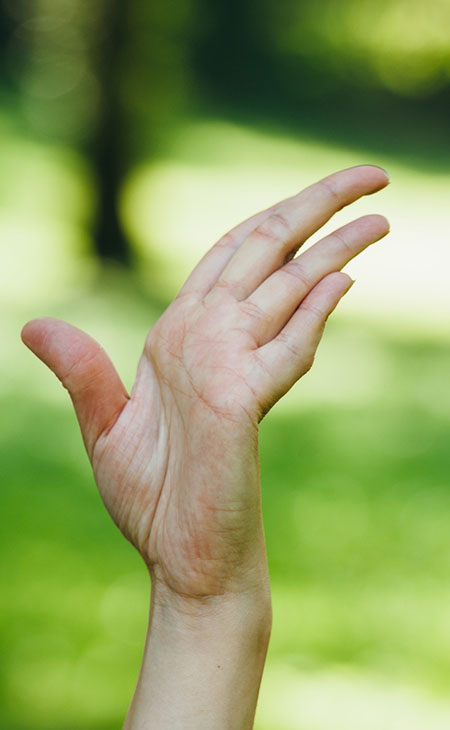 Sindrome da ipermobilita articolare