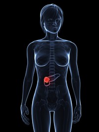 Tumore al pancreas