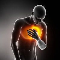 Infarto miocardico