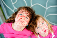 Morbillo