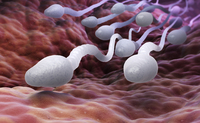 Astenoteratozoospermia