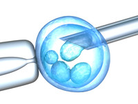Inseminazione intrauterina