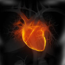 Angina stabile