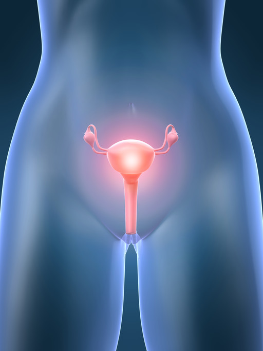 Cistoadenocarcinoma (neoplasie ovariche)