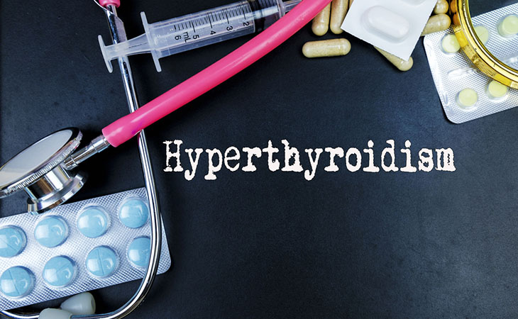 Ipertiroidismo subclinico