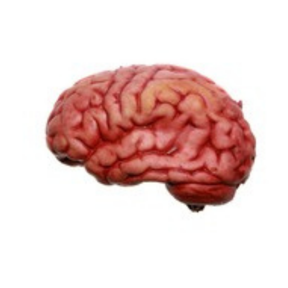 Leucotomia (lobotomia)