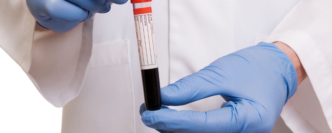 Piastrine Basse nel Flusso Sangugno