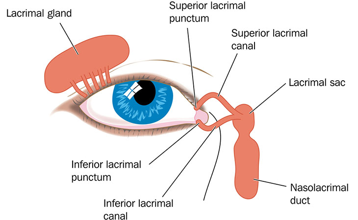 Sondaggio vie lacrimali