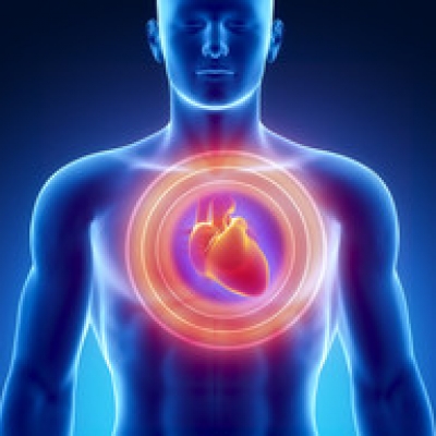 Cardiopatia ischemica