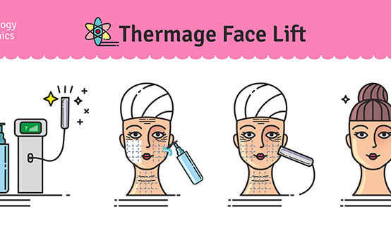 Thermage corpo