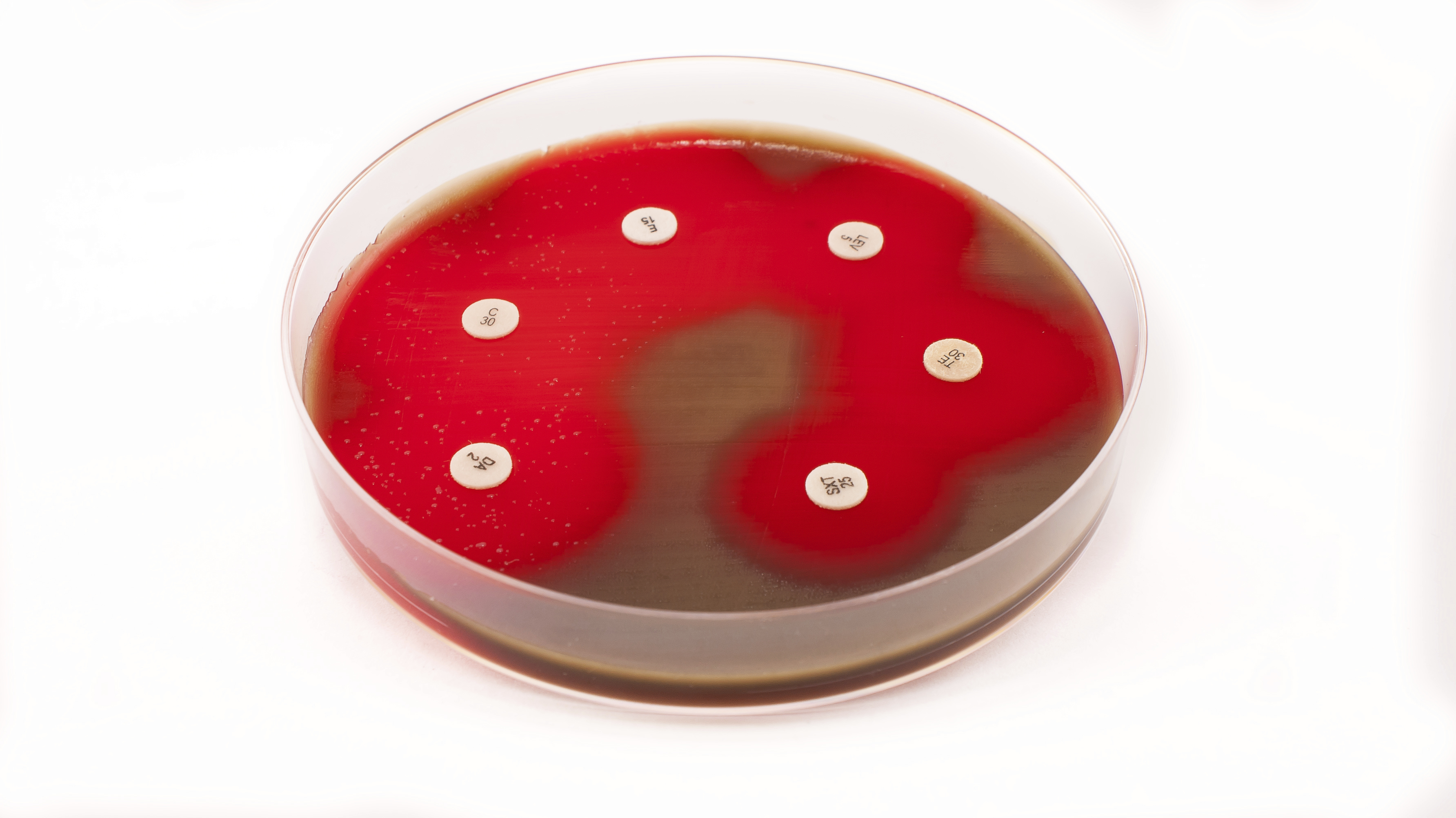 Meningite stafilococcica