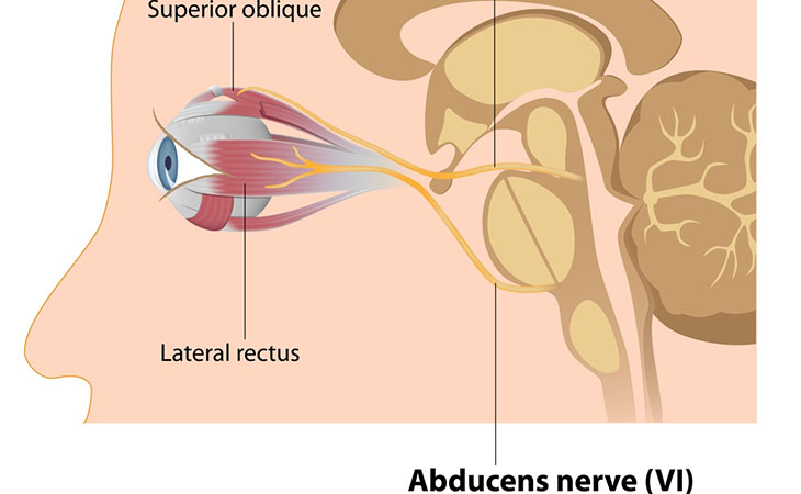 Nervo abducente