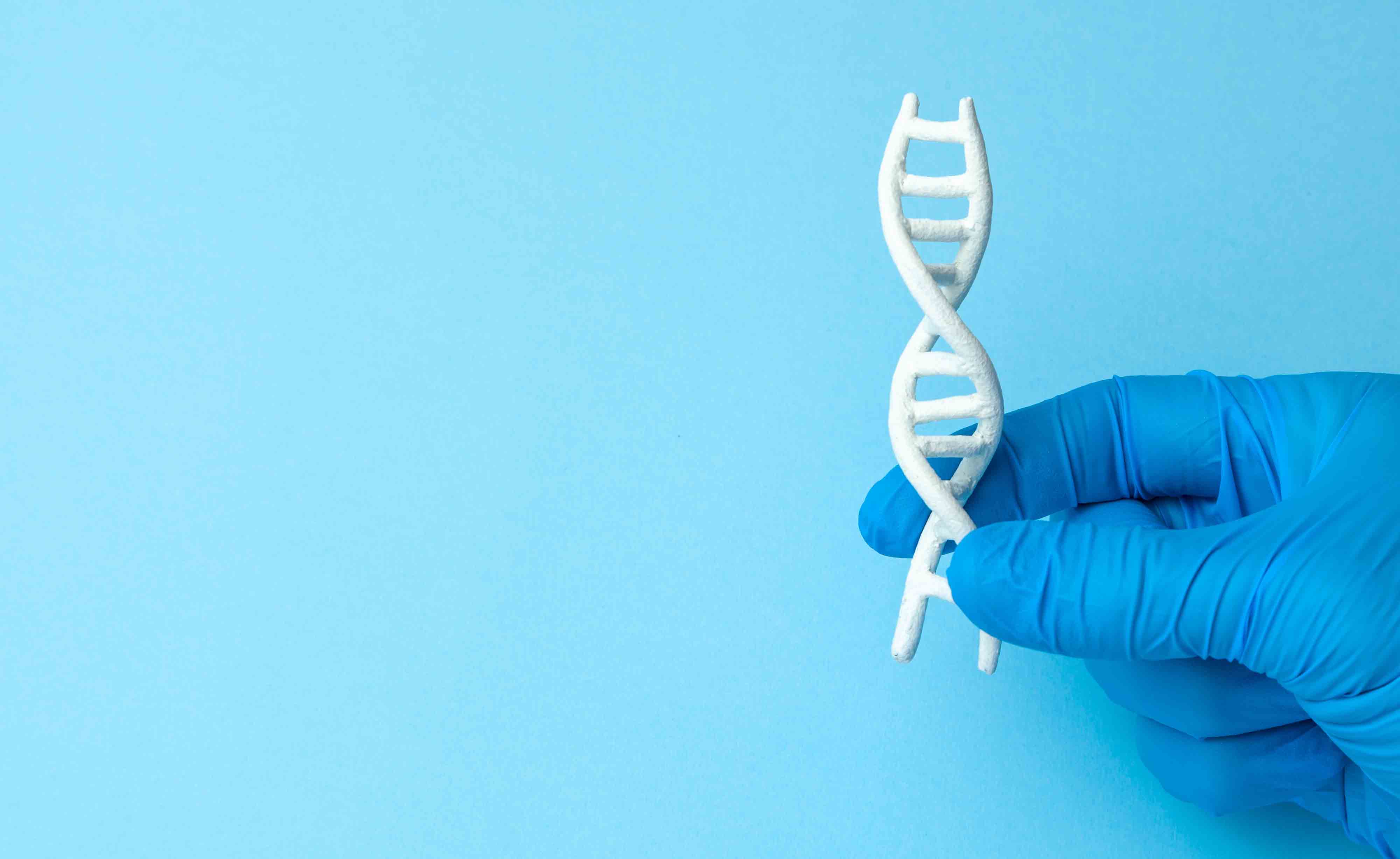 Sindrome di Prader-Willi