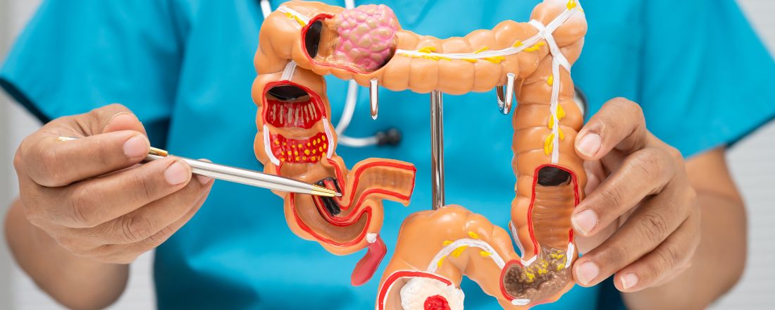 gastroenterologo mostra piccolo plastico dell'intestino