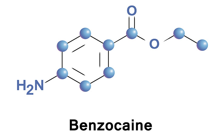 Benzocaina