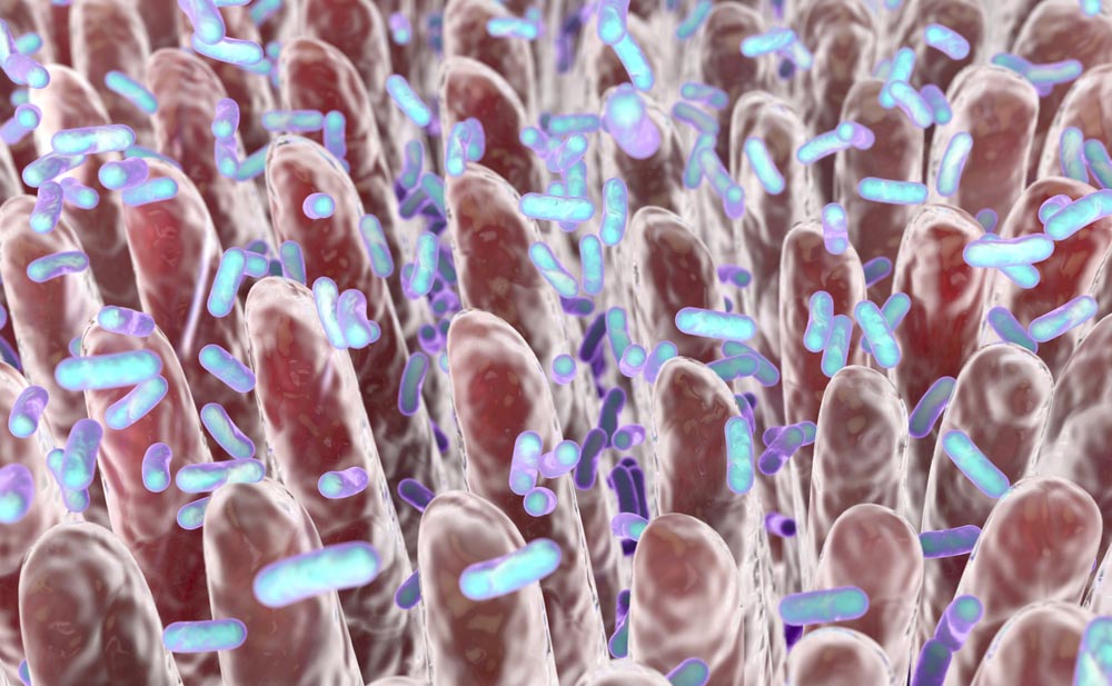Anastomosi intestinale