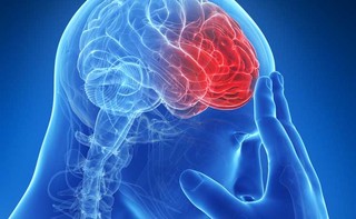 Vasculopatia cerebrale sintomi Vasculopatia cerebrale sintomi