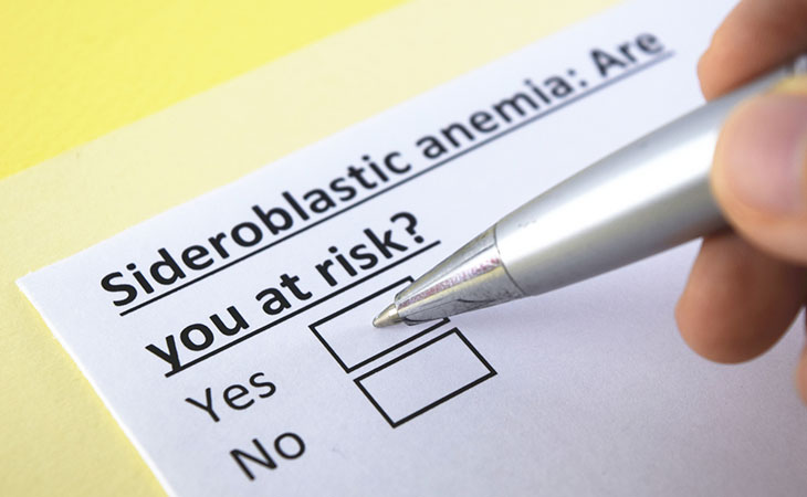 Anemia Sideroblastica