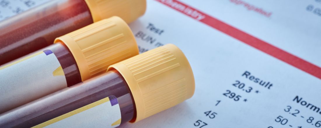 provette di esami del sangue